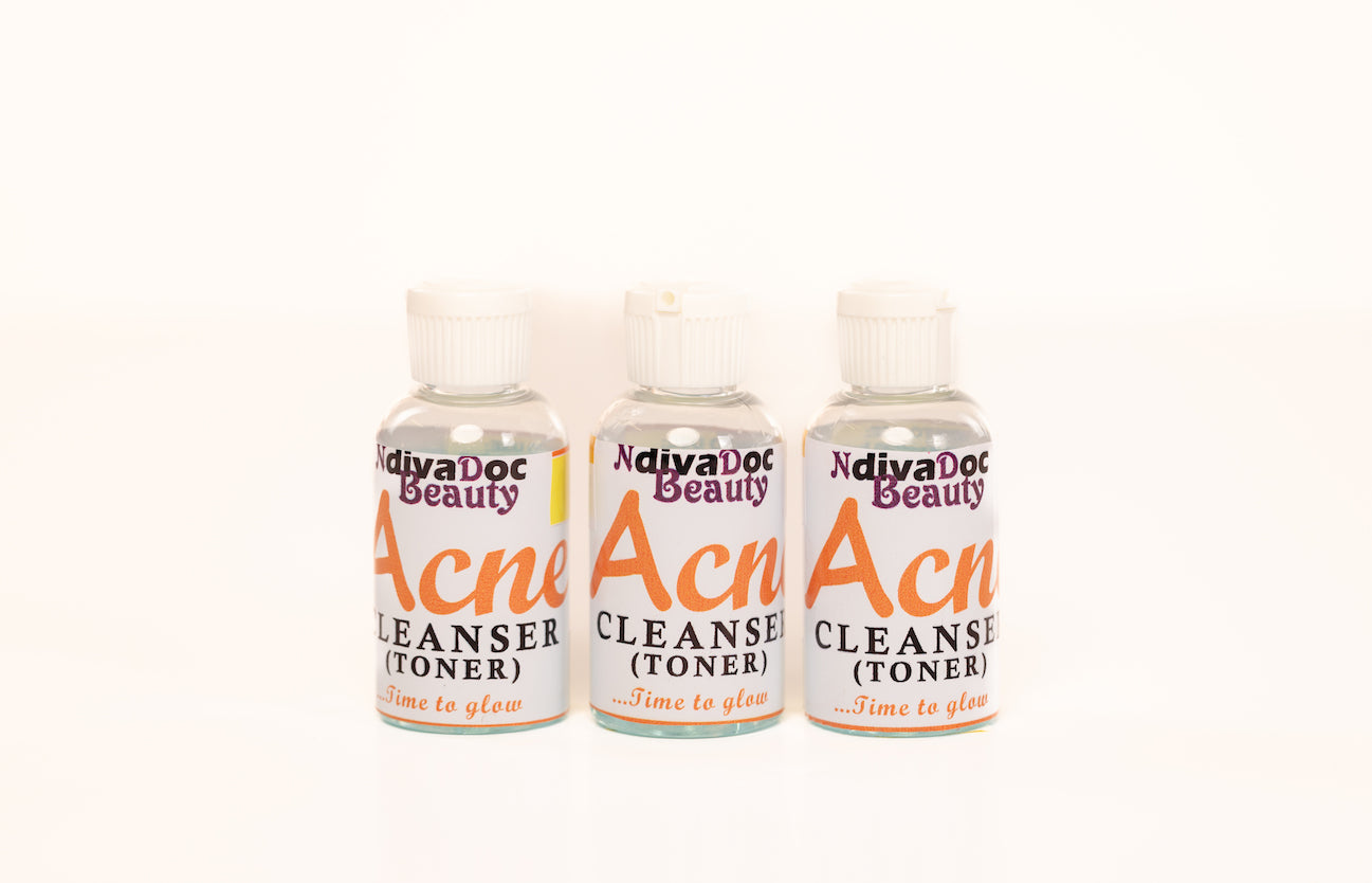 Acne Cleanser (2oz)